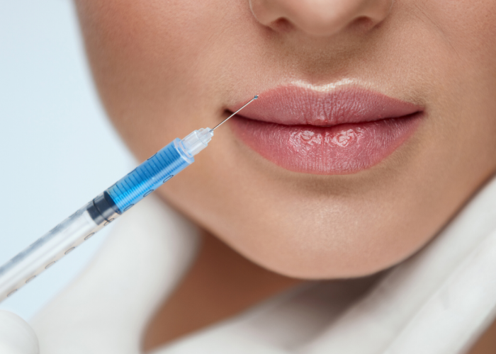 Что нужно знать, если ты решилась на процедуру увеличения губ?