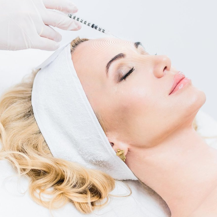 Коррекция морщин препаратом ботулотоксина А