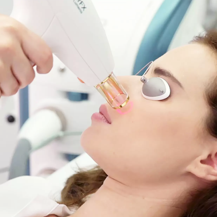 Лазерное омоложение лица