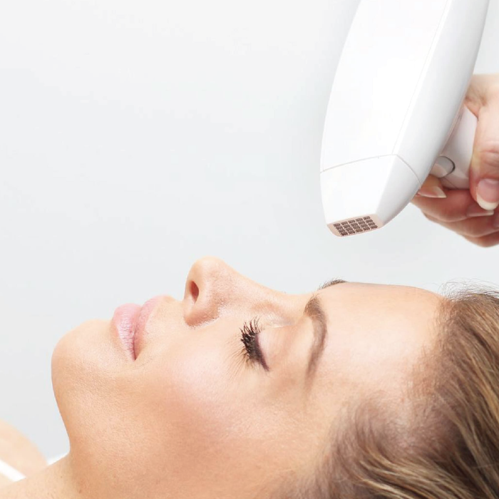 РФ лифтинг на аппарате VenusViva